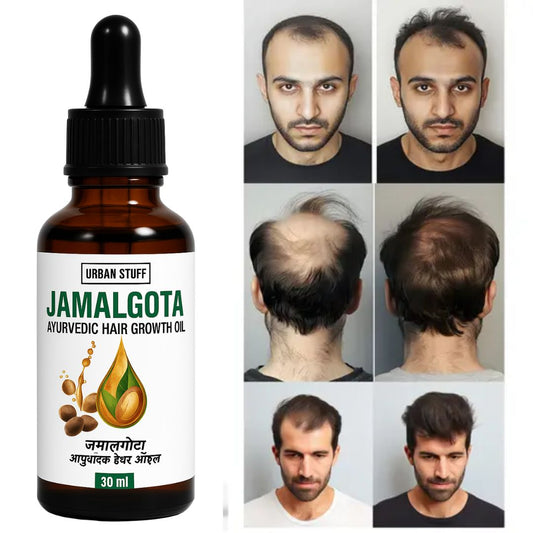 Jamalgota Hair Growth Oil