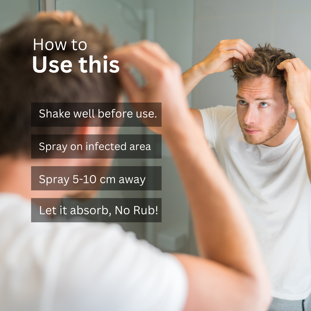 ScalpXpert Anti Fungal Scalp Spray - Buy 1 Get 1 Free🔥🔥