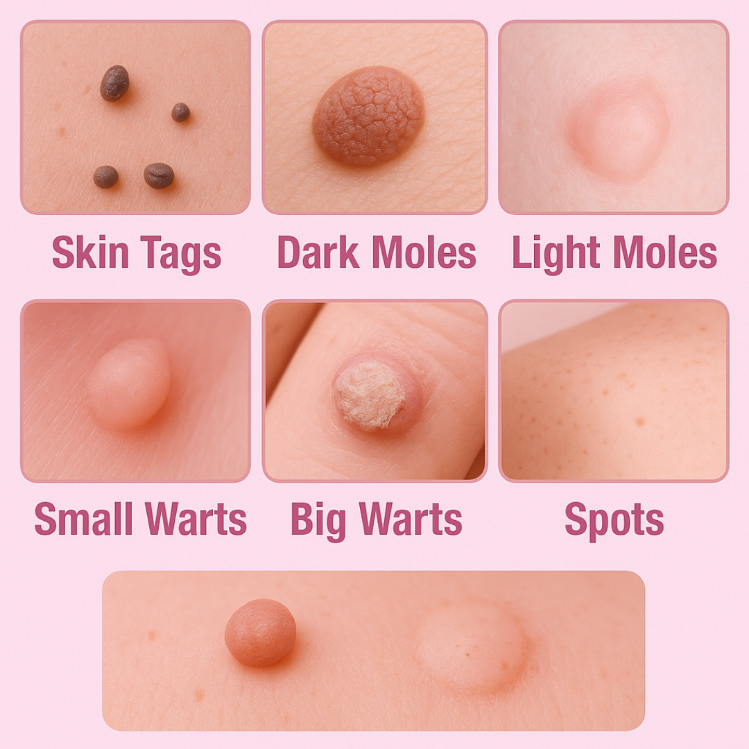 Wartocin Wart & Skin Tag Remover - 30ml