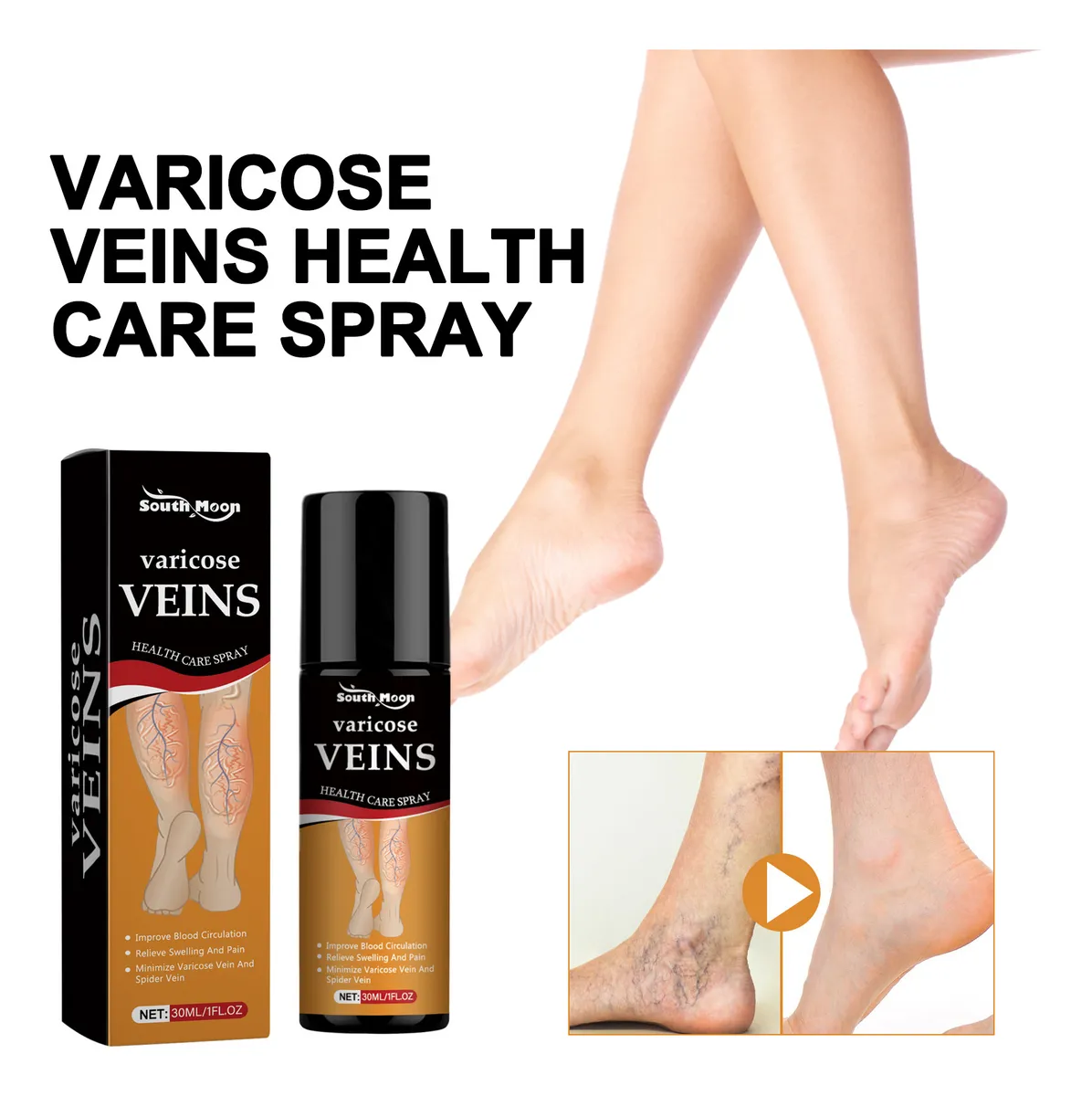 Varicose Veins Relief Herbal Spray - (Buy 1 Get 1 FREE🔥🔥)