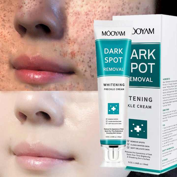 MOOYAM Korean Whitening & Melasma Cream- (Buy 1 Get 1 FREE)