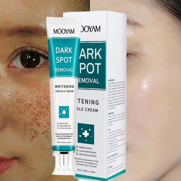 MOOYAM Korean Whitening & Melasma Cream- (Buy 1 Get 1 FREE)