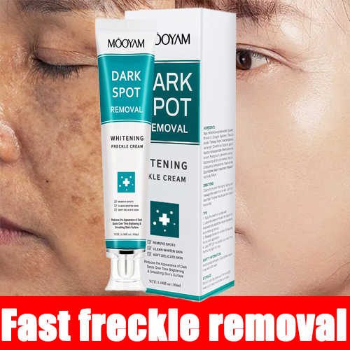 MOOYAM Korean Whitening & Melasma Cream- (Buy 1 Get 1 FREE)
