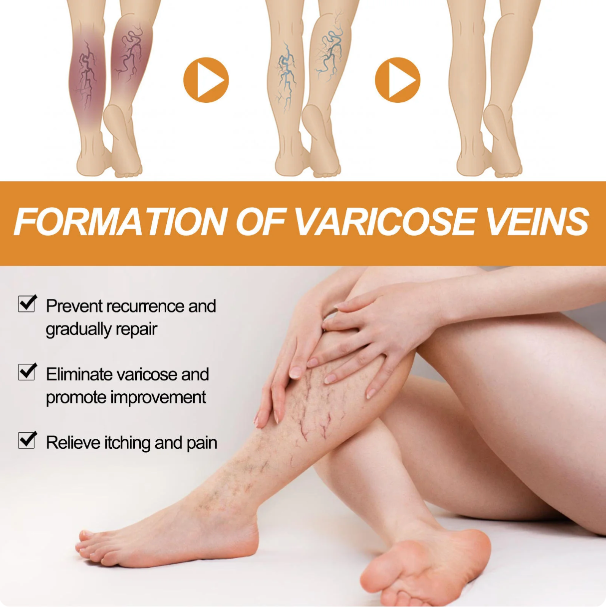 Turmeric Varicose Veins Relief Spray - (Buy 1 Get 1 FREE🔥🔥)