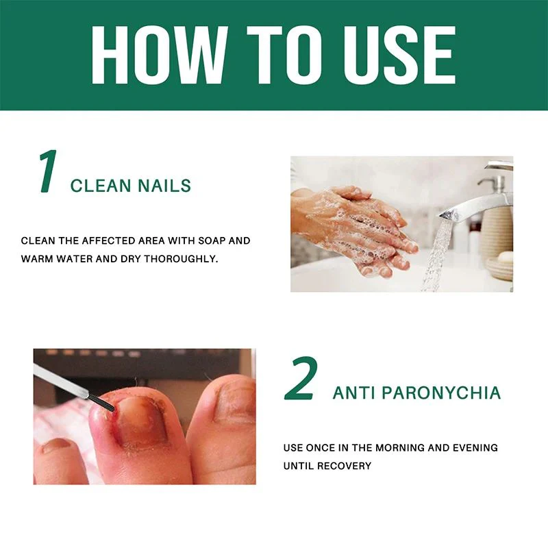 Anti Paronychia Relief Oil - (Buy 1 Get 1 FREE🔥🔥)