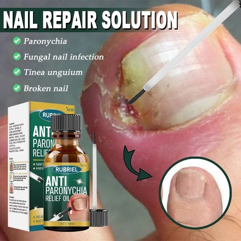 Anti Paronychia Relief Oil - (Buy 1 Get 1 FREE🔥🔥)