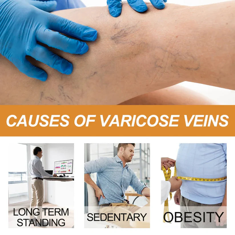 Vein Healing Varicose Veins Treatment Spray (Buy 1 Get 1 Free)