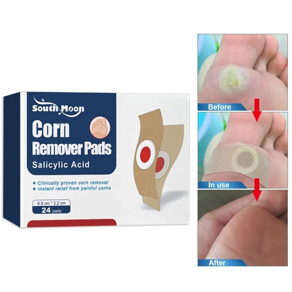 Corn Remover Pads (Pack of 24) - Buy 1 Get 1 Free🔥🔥