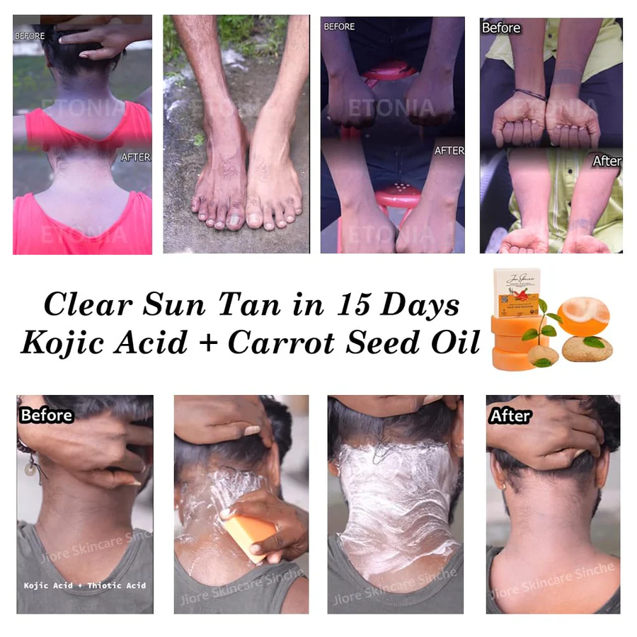 Kojic Skin Whitening Soap – Glow Up, Tan Out!