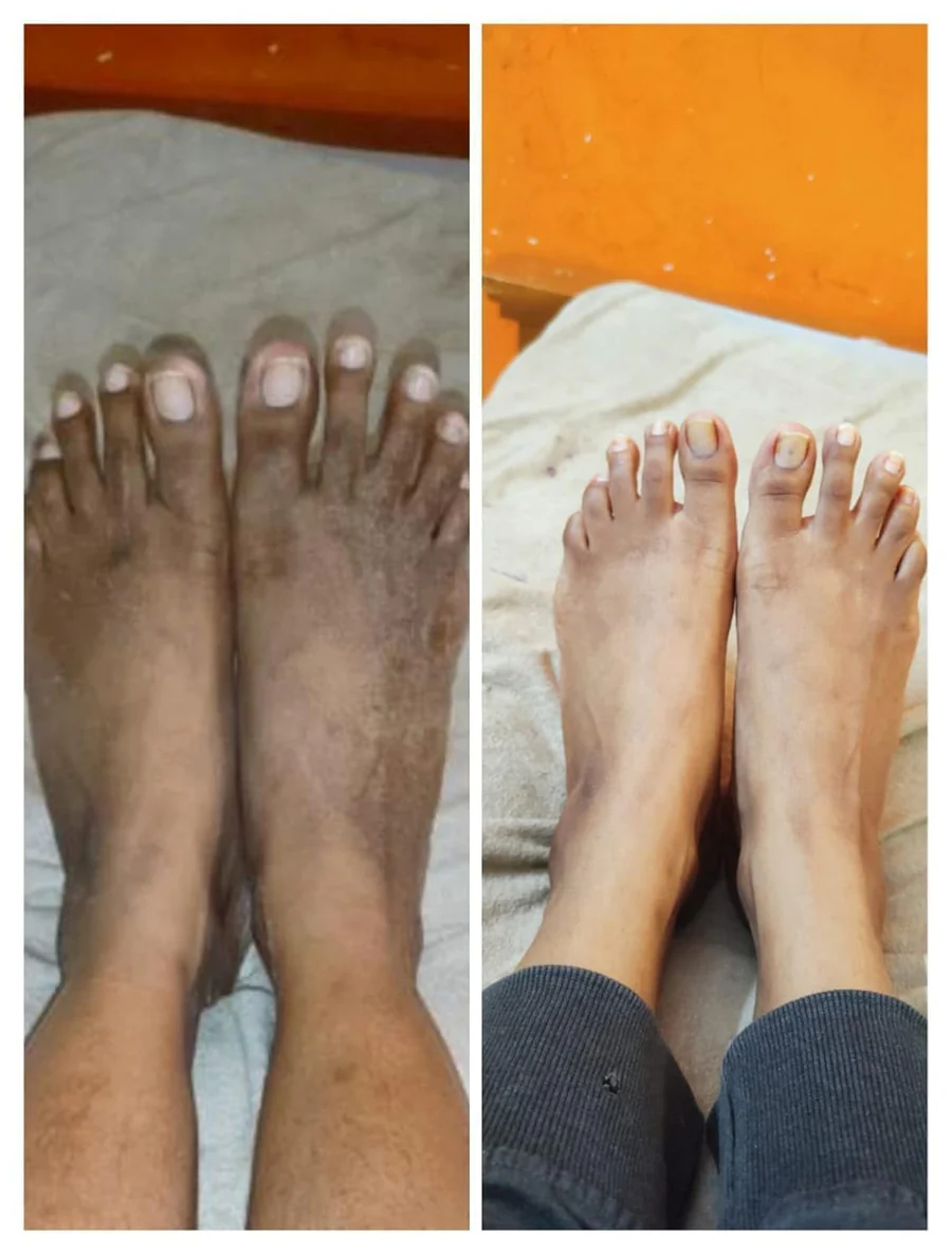 Kojic Skin Whitening Soap – Glow Up, Tan Out!