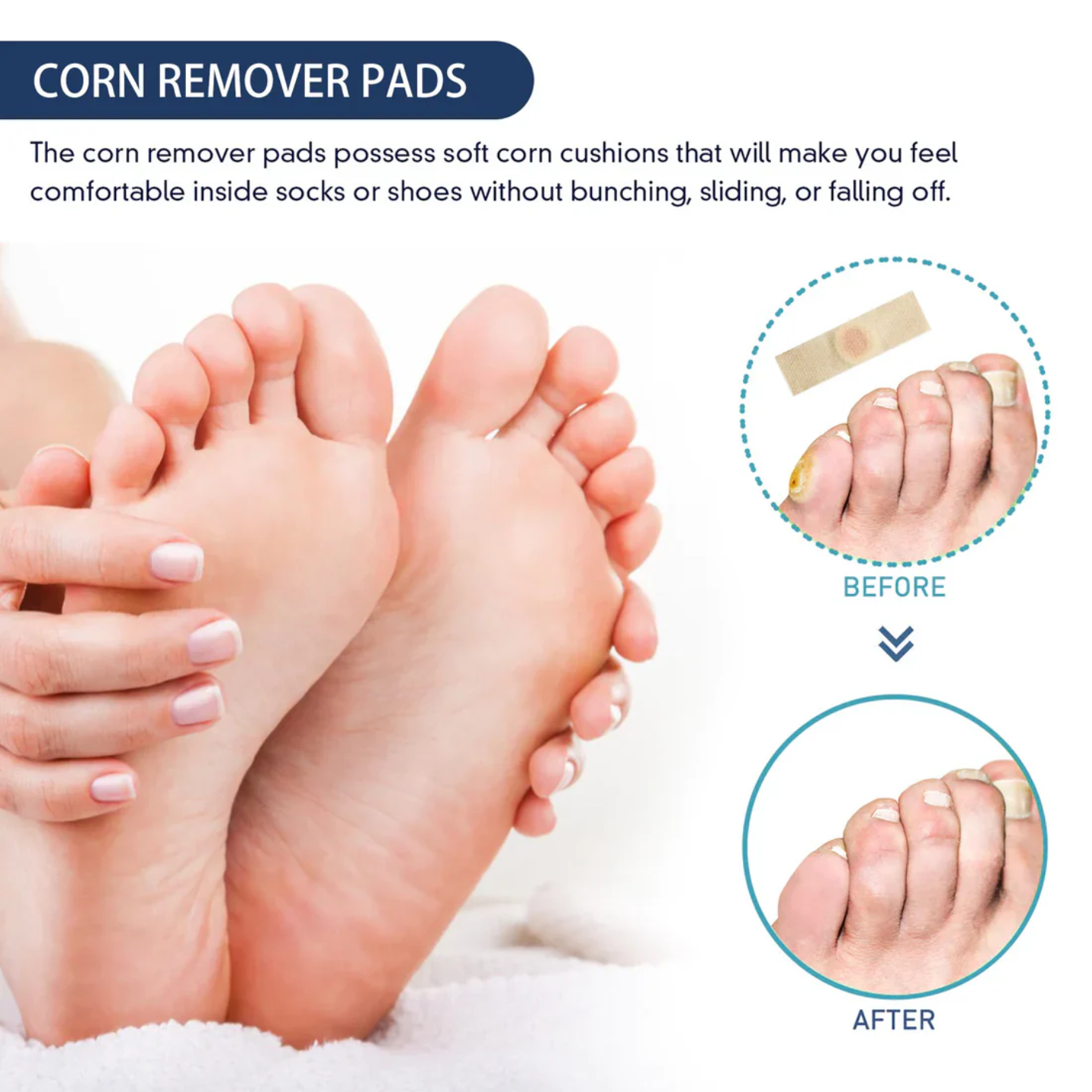 Corn Remover Pads (Pack of 24) - Buy 1 Get 1 Free🔥🔥