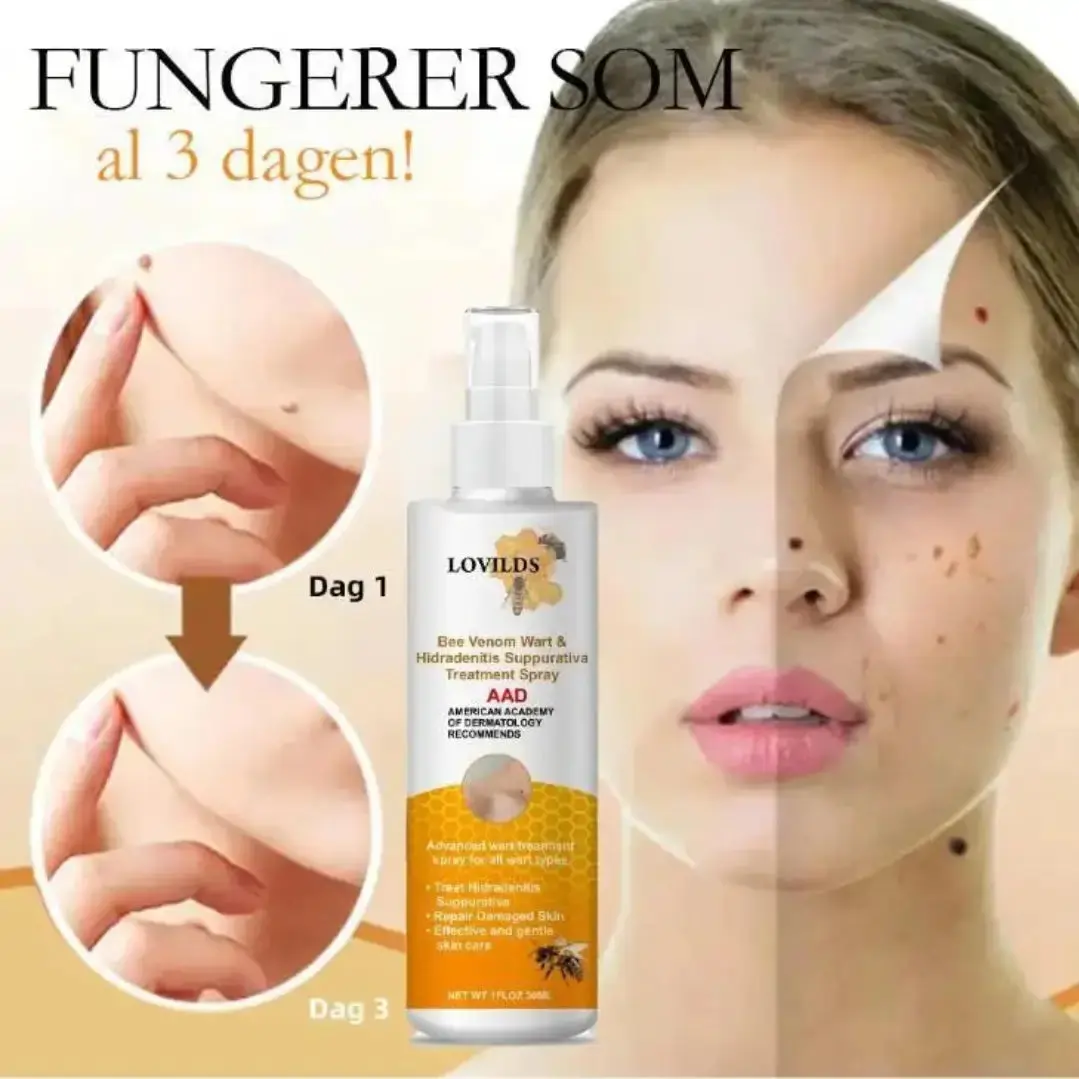 Wart & Skin Tags Remover Spray -  (Buy 1 Get 1 FREE🔥🔥)